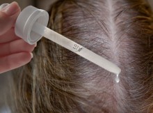 Alfatradiol: farmaci cura alopecia
