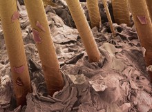 analisi tricologica dei capelli: tricogramma