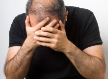 protesi e parrucchini - alopecia