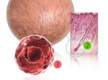 Alopecia e cura dei capelli