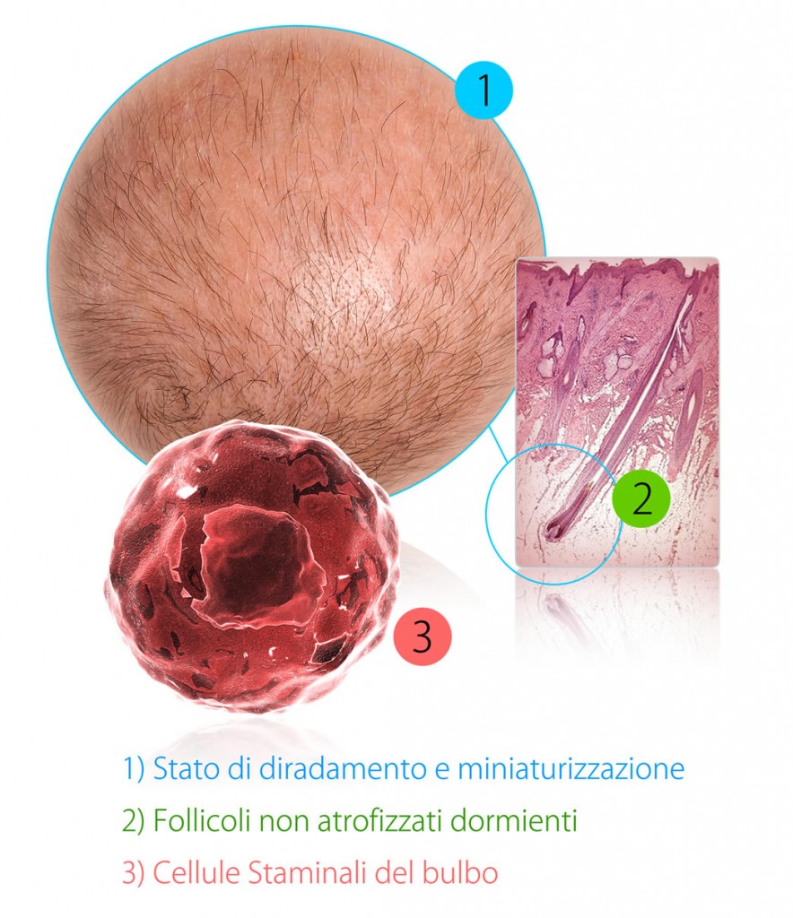 Alopecia e cura dei capelli