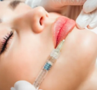 Filler labbra ad Ascoli Piceno